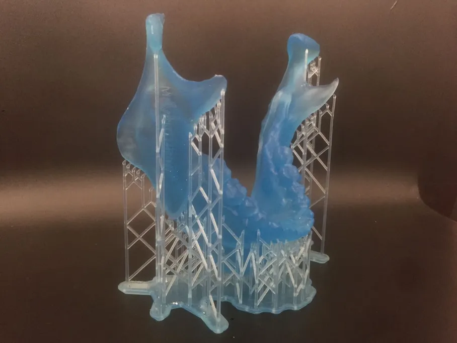 Guía quirúrgica impresa en 3D con sus soportes